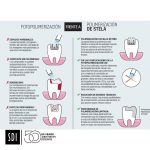 Composite-Stela-Automix