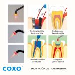 Coxo Z&H – Lámpara LED Fotocurado - Imagen 4