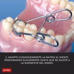 Matrices Contorneadas