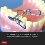 Matrices Contorneadas